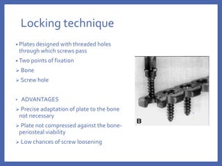 Locking technique
• Plates designed with threaded holes
through which screws pass
• Two points of fixation
 Bone
 Screw hole
• ADVANTAGES
 Precise adaptation of plate to the bone
not necessary
 Plate not compressed against the bone-
periosteal viability
 Low chances of screw loosening
 