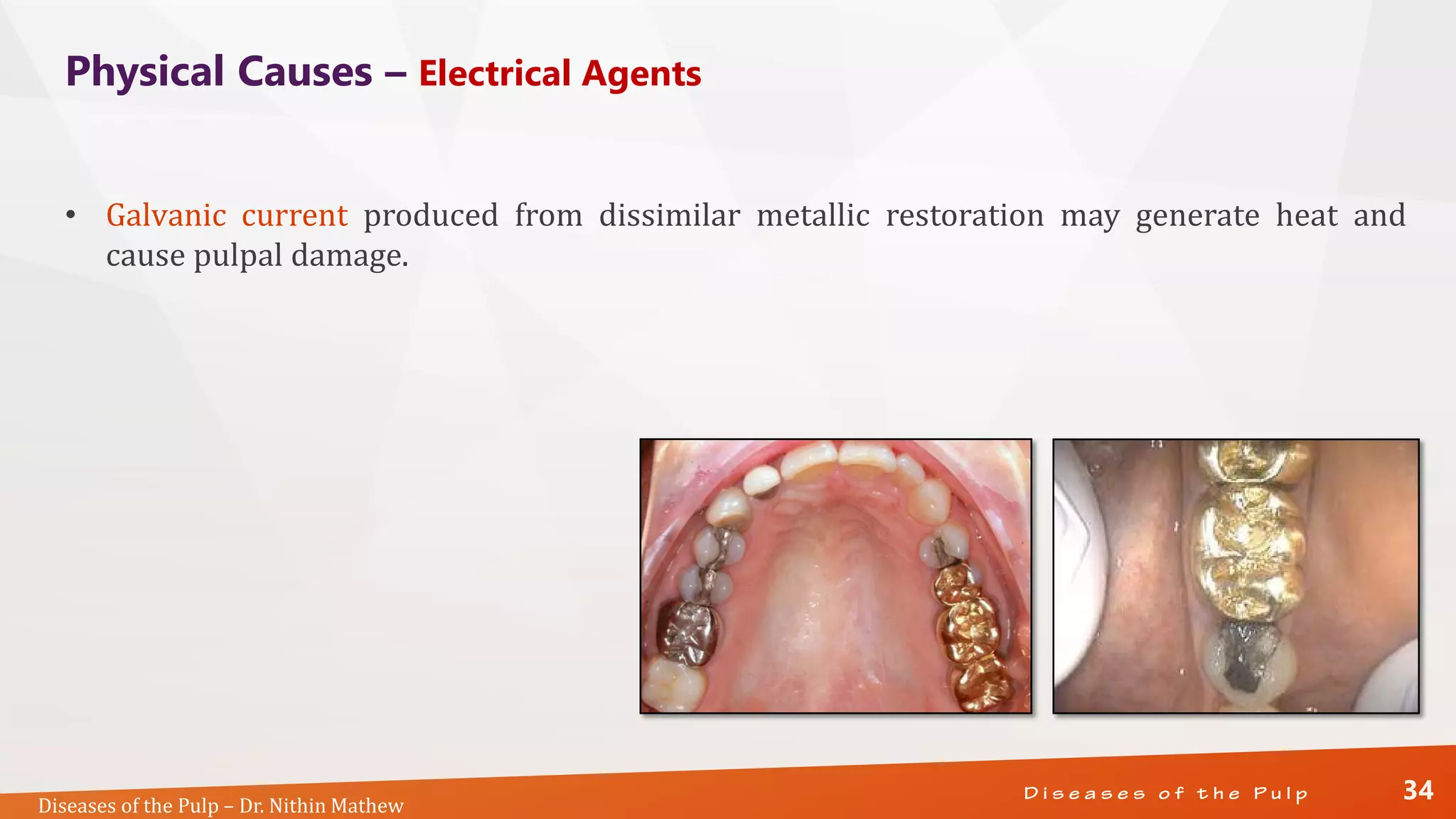 Diseases of the Pulp
