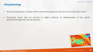 Diseases of the Pulp | PDF