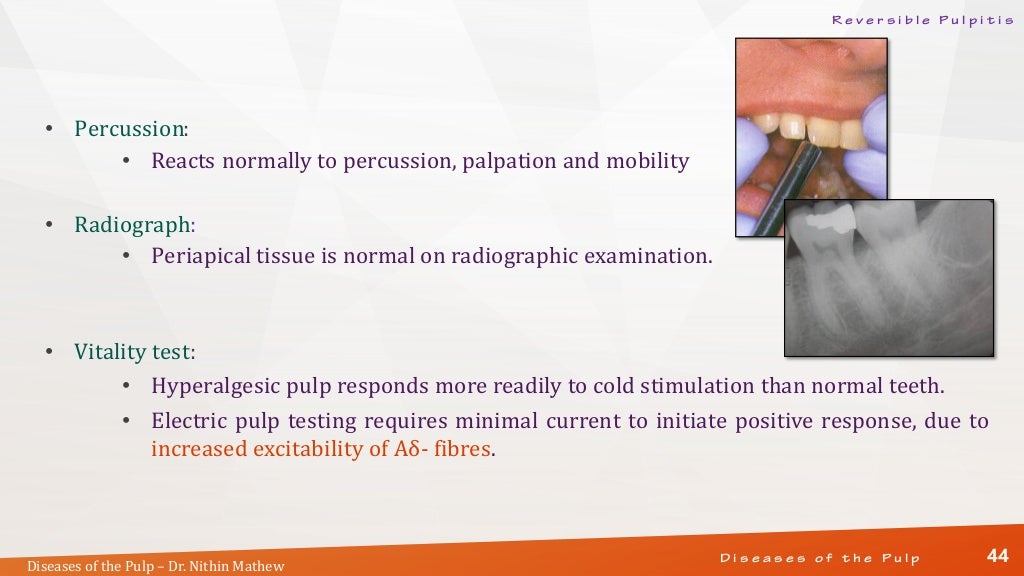 Diseases of the Pulp