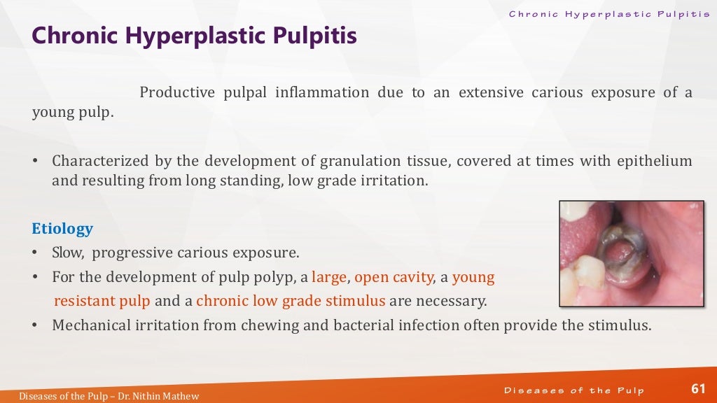 Diseases of the Pulp