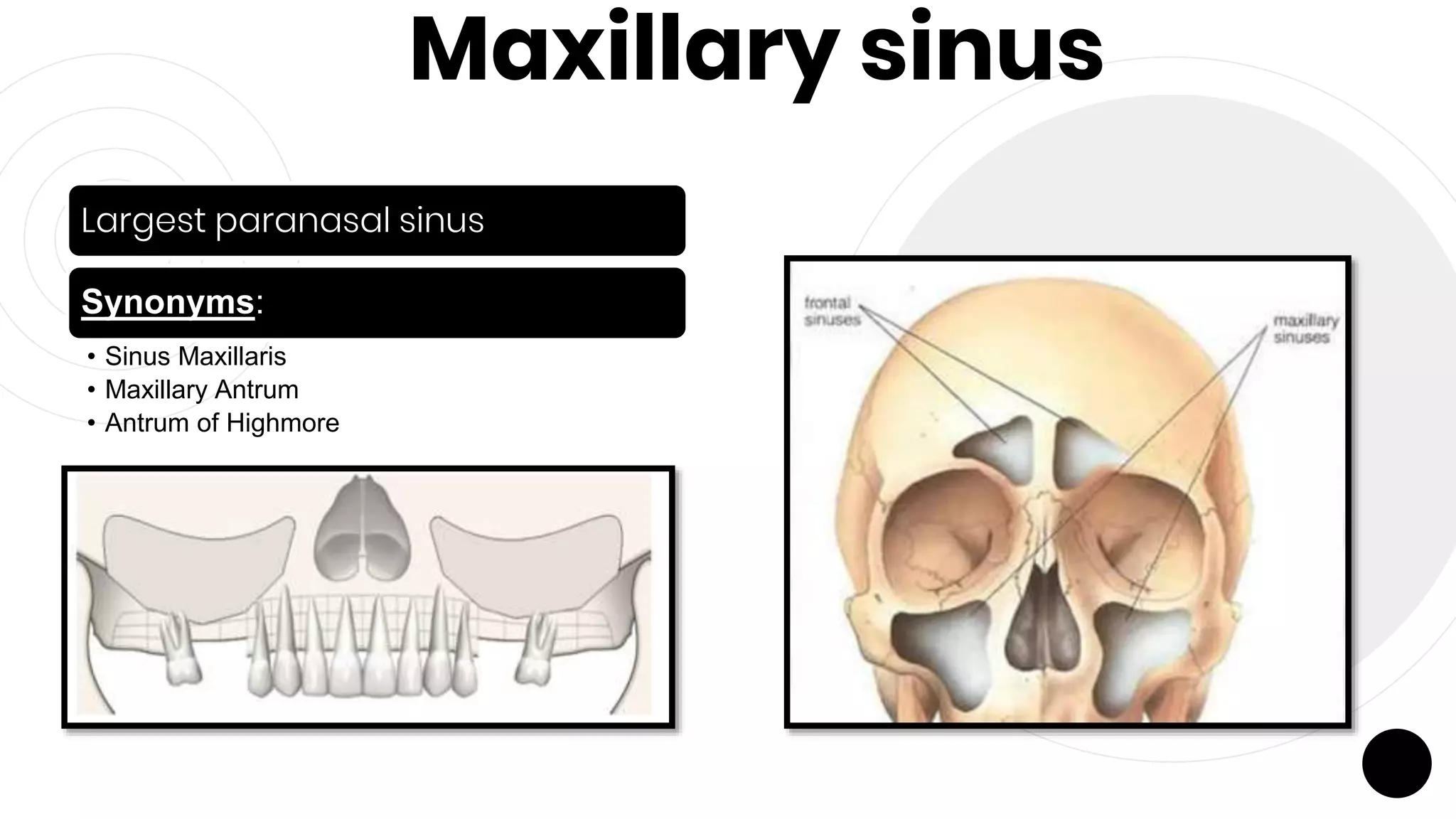 Maxillary sinus
Largest paranasal sinus
Synonyms:
• Sinus Maxillaris
• Maxillary Antrum
• Antrum of Highmore
 