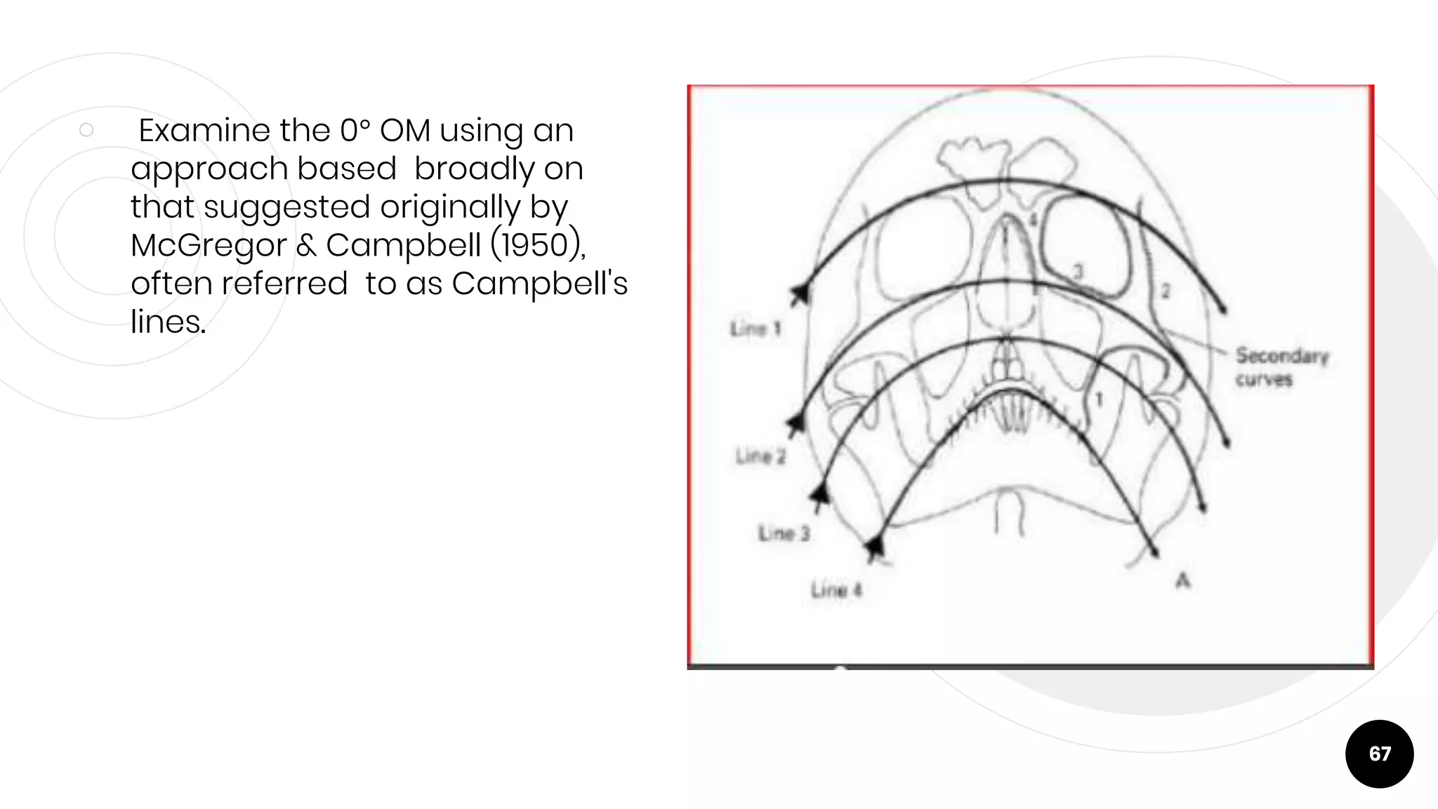 ￮ Examine the 0° OM using an
approach based broadly on
that suggested originally by
McGregor & Campbell (1950),
often referred to as Campbell's
lines.
67
 
