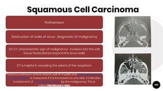 Squamous Cell Carcinoma
103
Radiopaque
Destruction of walls of sinus- diagnostic of malignancy
On CT, characteristic sign of malignancy- invasion into the soft
tissue facial planes beyond the sinus walls
CT is helpful in revealing the extent of the neoplasm
Distance between antero-lateral wall of maxilla and coronoid process
of the mandible is measured. If it is increased on one side, it indicates
involvement of infratemporal fossa by the malignancy. This is
called Handousa's sign.
 