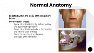 Normal Anatomy
￮ Located within the body of the maxillary
bone
￮ Pyramidal in shape
￮ Apex: directed laterally, is formed by
the zygomatic process
￮ Base: directed medially, is formed by
the lateral wall of nose
￮ Floor: formed by the alveolar
process of the maxilla
 