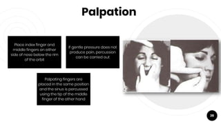 Palpation
28
Place index finger and
middle fingers on either
side of nose below the rim
of the orbit
If gentle pressure does not
produce pain, percussion
can be carried out
Palpating fingers are
placed in the same position
and the sinus is percussed
using the tip of the middle
finger of the other hand
 