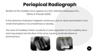 Periapical Radiograph
Borders of the maxillary sinus appear as a thin, delicate radiopaque line .
(White & Pharoah 2000)
In the absence of disease it appears continuous, but on close examination it has
small interruptions in its smoothness or density.
The roots of maxillary molars usually lie in close apposition to the maxillary sinus
and may project into the floor of the sinus, causing small elevations or
prominences.
34
 