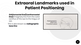 Extraoral Landmarks used in
Patient Positioning
￮ Orbitomental line(Canthomeatal
line): Imaginary line from the outer
canthus of the eye to the tragus of
ear.
This is also known as radiographic
base line
39
 