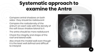 Systematic approach to
examine the Antra
• Compare antral shadows on both
sides- they should be radiolucent
• Compare the radiodensity of the
antrum on each side with the density of
the soft tissue shadow lateral to it
• The antra should be more radiolucent
• Check the integrity and shape of the
roof and lateral walls
• Also check the medial wall even though
it is the least well defined and difficult
to interpret
45
 