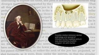8
Possible relation between dental
pathology and spread of
infection to the maxillary antrum
was described by Scottish
surgeon- Sir John Hunter
 