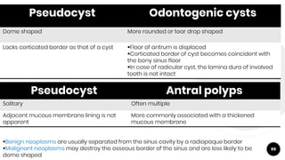 88
Pseudocyst Odontogenic cysts
Dome shaped More rounded or tear drop shaped
Lacks corticated border as that of a cyst Floor of antrum is displaced
Corticated border of cyst becomes coincident with
the bony sinus floor
In case of radicular cyst, the lamina dura of involved
tooth is not intact
Pseudocyst Antral polyps
Solitary Often multiple
Adjacent mucous membrane lining is not
apparent
More commonly associated with a thickened
mucous membrane
Benign neoplasms are usually separated from the sinus cavity by a radiopaque border
Malignant neoplasms may destroy the osseous border of the sinus and are less likely to be
dome shaped
 