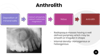 Anthrolith
• Radiopaque masses having a well
defined periphery which may be
smooth or irregular in shape
• Internal density- Homogenous or
heteogenous
89
Deposition of
mineral salts
Calcium phosphate,
calcium carbonate,
magnesium
Nidus Antrolith
 