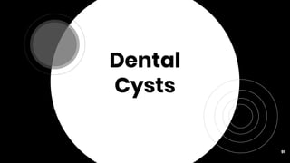 Dental
Cysts
91
 