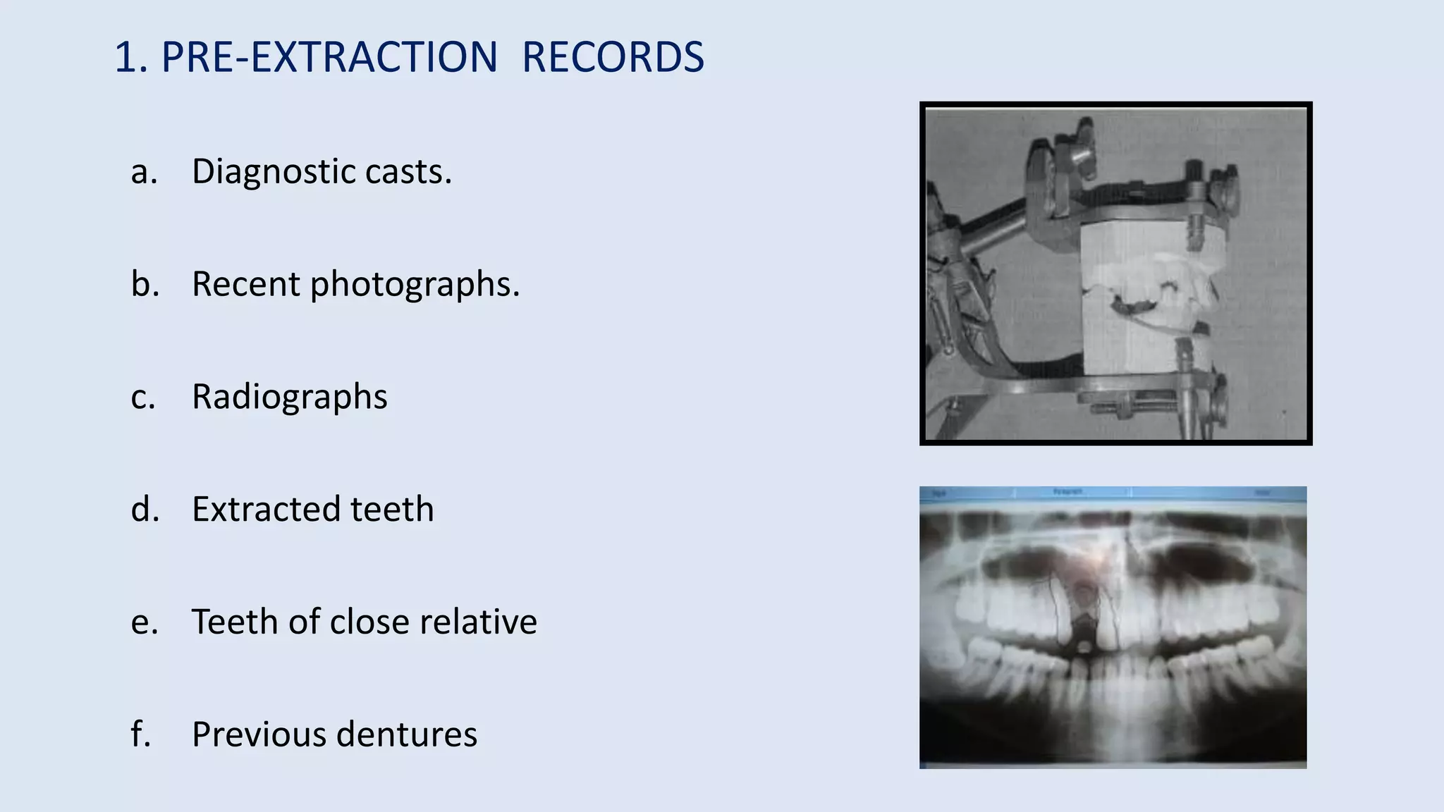 Pre Extraction Radiograph SEMINAR 9 TEETH SELECTION.pptx