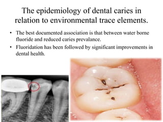 Details of Trace elements in oral health | PPTX