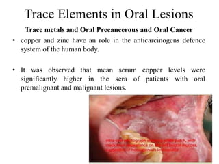 Details of Trace elements in oral health | PPTX