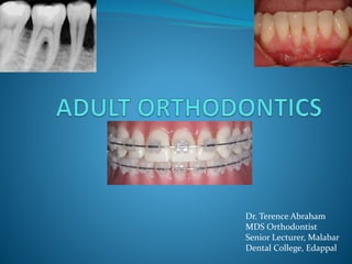 Dr. Terence Abraham
MDS Orthodontist
Senior Lecturer, Malabar
Dental College, Edappal
 