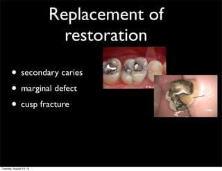 Replacement of
restoration
• secondary caries
• marginal defect
• cusp fracture

Tuesday, August 13, 13

 