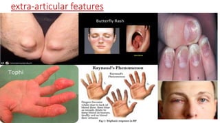 articular features-extra
 