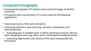 Computed tomography
• Computed tomography (CT) obtains cross-sectional images of skeletal
structures.
• In a patient with a painful joint, CT is most useful for the following
applications:
• Assessing trauma of the spine and pelvis
• Evaluating arthritis in axial joints (eg, sacroiliac, atlantoaxial, and
sternoclavicular)
• Evaluating pain in complex joints in which overlying structures obscure
plain radiography views (eg, ankle, wrist, and temporomandibular joints)
• Evaluating degenerative disc disease of the spine and possible disc
herniations
 