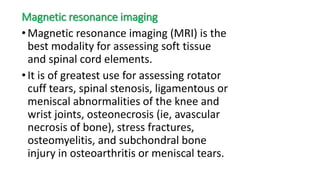 Magnetic resonance imaging
•Magnetic resonance imaging (MRI) is the
best modality for assessing soft tissue
and spinal cord elements.
•It is of greatest use for assessing rotator
cuff tears, spinal stenosis, ligamentous or
meniscal abnormalities of the knee and
wrist joints, osteonecrosis (ie, avascular
necrosis of bone), stress fractures,
osteomyelitis, and subchondral bone
injury in osteoarthritis or meniscal tears.
 