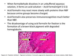 • When formaldehyde dissolves in an unbuffered aqueous
solution, it forms an acid solution – Acid Formalin(pH 5-5.5)
• Acid formalin may react more slowly with proteins than NBF
because amine groups become charged.
• Acid formalin also preserves immunorecognition much better
than NBF.
• The disadvantage of using acid formalin for fixation is the
formation of a brown-black pigment with degraded
hemoglobulin.
 