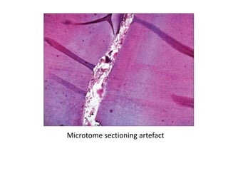 Microtome sectioning artefact
 