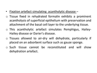 • Fixation artefact simulating acantholytic disease –
o Tissue fixed in rehydrated formalin exhibits a prominent
acantholysis of superficial epithelium with preservation and
attachment of the basal cell layer to the underlying tissue.
o This acantholytic artefact simulates Pemphigus, Hailey-
Hailey disease or Darier's disease.
o Tissues allowed to air-dry will dehydrate, particularly if
placed on an adsorbent surface such as gauze sponge.
o Such tissue cannot be reconstituted and will show
dehydration artefact.
 