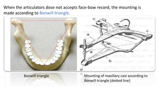 Bonwill Dental articulators | PPTX