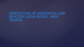 VERIFICATION OF HORIZONTAL JAW
RELATION USING GOTHIC ARCH
TRACING
 