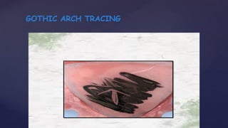 GOTHIC ARCH TRACING
 