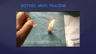 GOTHIC ARCH TRACING
 