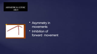 ASSYMETRICALGOTHIC
ARCH
• Asymmetry in
movements
• Inhibition of
forward movement
 