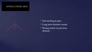  Not meeting at apex
 Long term denture wearer
 Wrong centric in previous
denture
ATYPICAL GOTHIC ARCH
 