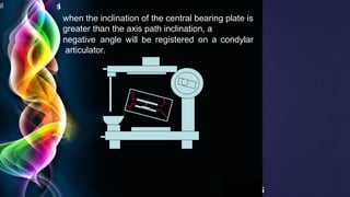 g
6
Page 3
I
s
when the inclination of the central bearing plate is
greater than the axis path inclination, a
negative angle will be registered on a condylar
articulator.
 