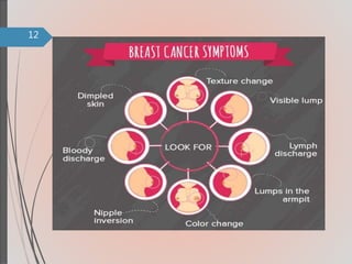 Breast cancer | PPTX