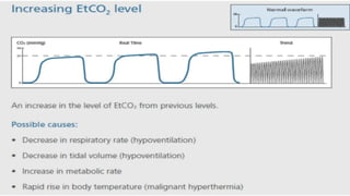 Types Capnography capnography and its types of graphs powerpoint | PPTX