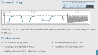 Types Capnography capnography and its types of graphs powerpoint | PPTX