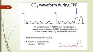 Types Capnography capnography and its types of graphs powerpoint | PPTX
