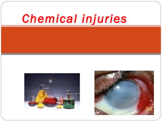 Chemical injuries
 