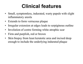 Clinical features
• Small, symptomless, indurated, warty papule with slight
inflammatory areola
• Extends to form verrucous plaque
• Irregular extension at edges leads to serpiginous outline
• Involution of centre forming white atrophic scar
• Firm and purplish, red or brown
• Skin biopsy from least keratotic area and incised deep
enough to include the underlying indurated plaque

 
