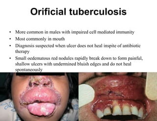 Orificial tuberculosis
• More common in males with impaired cell mediated immunity
• Most commonly in mouth
• Diagnosis suspected when ulcer does not heal inspite of antibiotic
therapy
• Small oedematous red nodules rapidly break down to form painful,
shallow ulcers with undermined bluish edges and do not heal
spontaneously

 