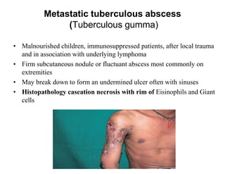 Metastatic tuberculous abscess
(Tuberculous gumma)
• Malnourished children, immunosuppressed patients, after local trauma
and in association with underlying lymphoma
• Firm subcutaneous nodule or fluctuant abscess most commonly on
extremities
• May break down to form an undermined ulcer often with sinuses
• Histopathology caseation necrosis with rim of Eisinophils and Giant
cells

 