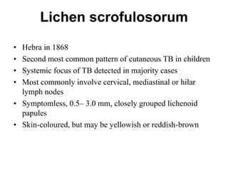 Lichen scrofulosorum
•
•
•
•

Hebra in 1868
Second most common pattern of cutaneous TB in children
Systemic focus of TB detected in majority cases
Most commonly involve cervical, mediastinal or hilar
lymph nodes
• Symptomless, 0.5– 3.0 mm, closely grouped lichenoid
papules
• Skin-coloured, but may be yellowish or reddish-brown

 