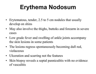 Erythema Nodosum
• Erytematous, tender, 2.5 to 5 cm nodules that usually
develop on shins
• May also involve the thighs, buttoks and forearm in severe
cases
• Low grade fever and swelling of ankle joints accompany
the skin lesions in some patients
• The lesions regress spontaneously becoming dull red,
violaceous
• Ulceration and scarring not the features
• Skin biopsy reveals a septal panniculitis with no evidence
of vasculitis

 