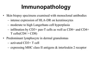 Immunopathology
• Skin biopsy specimens examined with monoclonal antibodies
– intense expression of HLA-DR on keratinocytes
– moderate to high Langerhans cell hyperplasia
– infiltration by CD3+ pan-T cells as well as CD8+ and CD4+
T cells(CD4 > CD8)
• Predominant lymphocyte in dermal granulomas
– activated CD3+ T cell
– expressing MHC class II antigens & interleukin 2 receptor

 