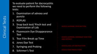 ClinicalTests To evaluate patient for dacrocystitis
we need to perform the following
tests:
1. Examination of adnexa and
puncta
2. ROPLAS
3. Snap back test/ Pinch test and
Examination of Lids
4. Fluorescein Dye Disappearance
Test
5. Tear Film Break up Time
6. Jones Dye Test
7. Syringing and Probing
8. Schirmer’s Test
ASSESS LACRIMAL DYSFUNCTION
ASSESS LACRIMAL DRAINAGE FUNCTION
AND PATENCY
ASSESS LEVEL OF OBSTRUCTION
ASSESS TEAR PRODUCTION
 