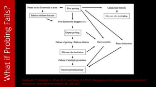 WhatifProbingFails?
Takahashi, Y., Kakizaki, H., Chan, W. O. and Selva, D. (2010), Management of congenital nasolacrimal duct
obstruction. Acta Ophthalmologica, 88: 506–513.
 