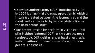 •Dacryocystorhinostomy (DCR) introduced by Toti
in 1904 is a lacrimal drainage operation in which a
fistula is created between the lacrimal sac and the
nasal cavity in order to bypass an obstruction in
the nasolacrimal duct.
•The procedure can be performed via an external
skin incision (external DCR) or through the nose
(endoscopic DCR), either under local anesthesia,
with or without intravenous sedation, or under
general anesthesia.
DCR
 
