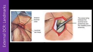 ExternalDCR:Landmarks
 